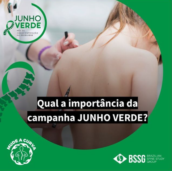 Junho Verde: Médico da Unimed explica causas da escoliose